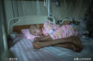 Girl height 1.65 meters of weight only remnant 40 