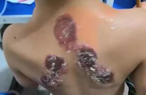 "Wintry ill summer is treated " three fit perfec