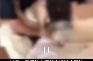 Is net marriage exposing to the sun troubled by a 