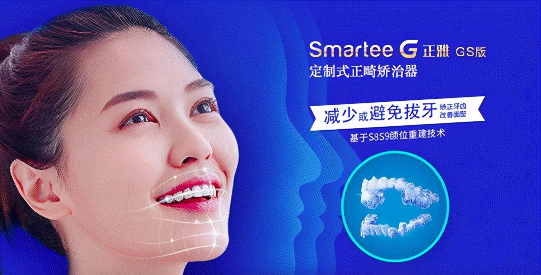 毛利率70%以上，你所不知道的隐形牙套暴利堪比茅台