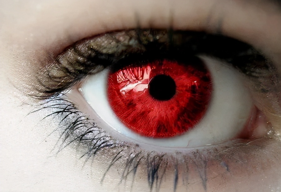 异瞳真的存在●但其实,瞳孔的颜色可不止这些,比如绿色,红色,紫色
