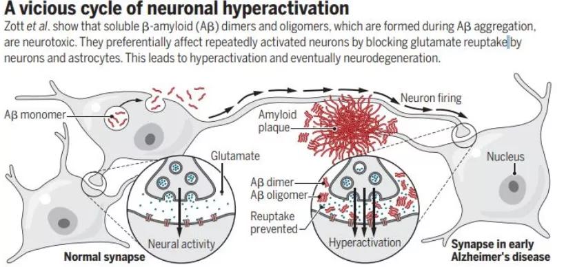 熬夜通宵、嗜糖嗜咸的我们，离阿尔茨海默病有多远？