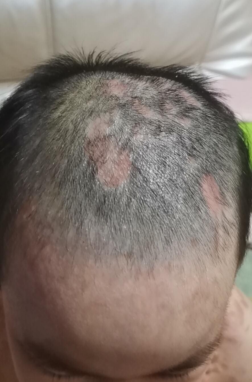 抚顺6岁女童被“打断”的童年