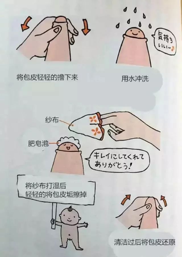 10男9包不割包皮对男宝有什么影响女生禁入