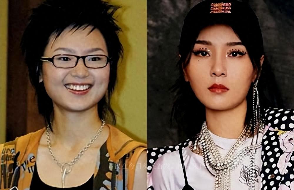 Zhou Bichang Succeeded In Plastic Surgery And Admitted Generously I