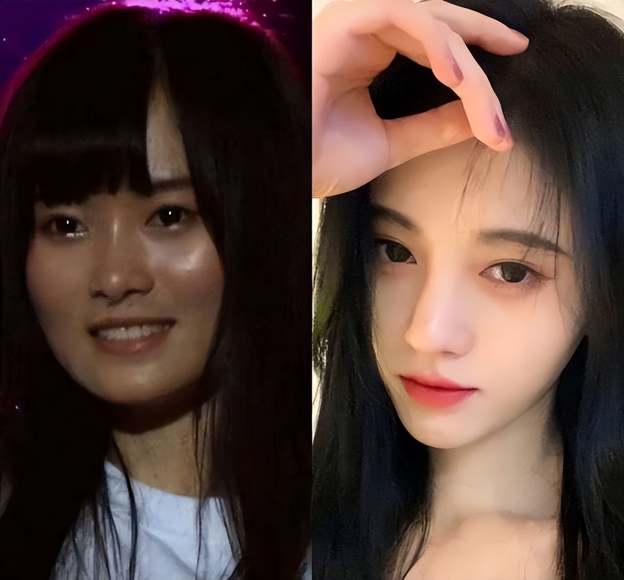 Ju Jingyi Was Complained About Too Much Plastic Surgery It Was Like