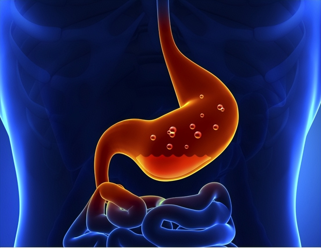 Bile Reflux Gastritis Should Not Be Underestimated It Is A Risk Factor