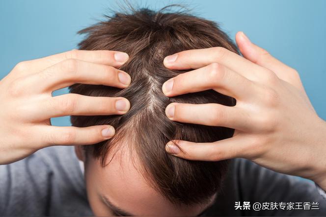 为什么有的人没有眉毛？