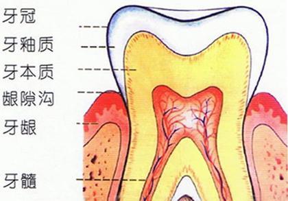 牙齿冠折是什么意思(牙齿冠折怎么治疗)