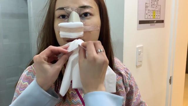 韩国隆鼻手术多少钱(隆鼻假体可以永久的吗)