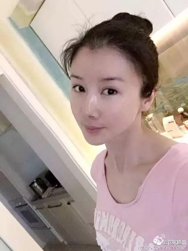 7大女明星整容失败越变越丑 萧蔷脸肿嘴歪 巩新亮成“僵尸新娘”
