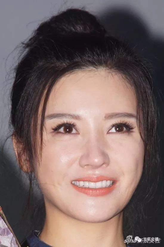 7大女明星整容失败越变越丑 萧蔷脸肿嘴歪 巩新亮成“僵尸新娘”