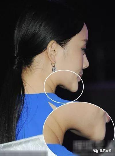 7大女明星整容失败越变越丑 萧蔷脸肿嘴歪 巩新亮成“僵尸新娘”