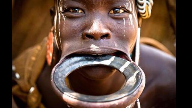 非洲的女性割礼是什么意思呢割礼后丈夫怎么进去