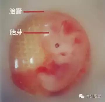 胚芽什么意思(未见明显胚芽是死胎吗)