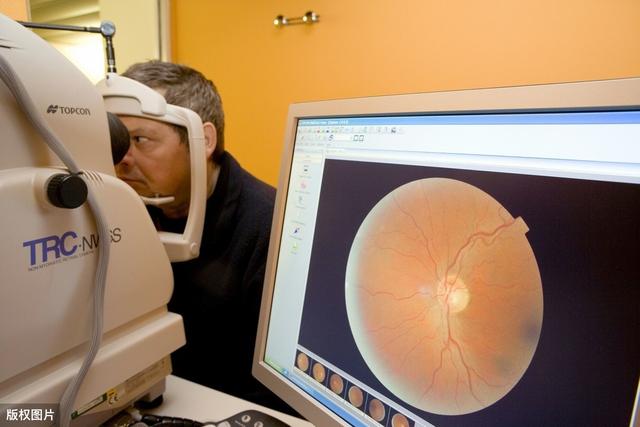 长期血糖高视力模糊，医生：需要做这些检查，可能是视网膜病变