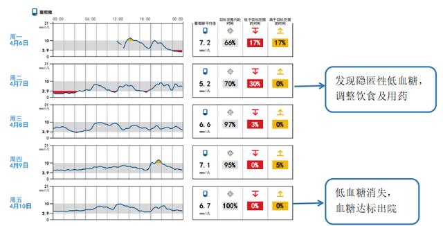 借力动态血糖图谱分析，优化患者血糖管理