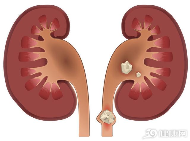 腎好什麼意思(男生說腎好是什麼意思)