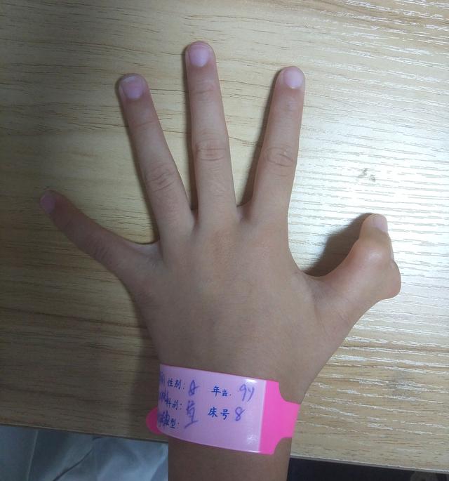 隐秘的角落:九岁患儿手上的秘密!先天性多指畸形,早治很关键