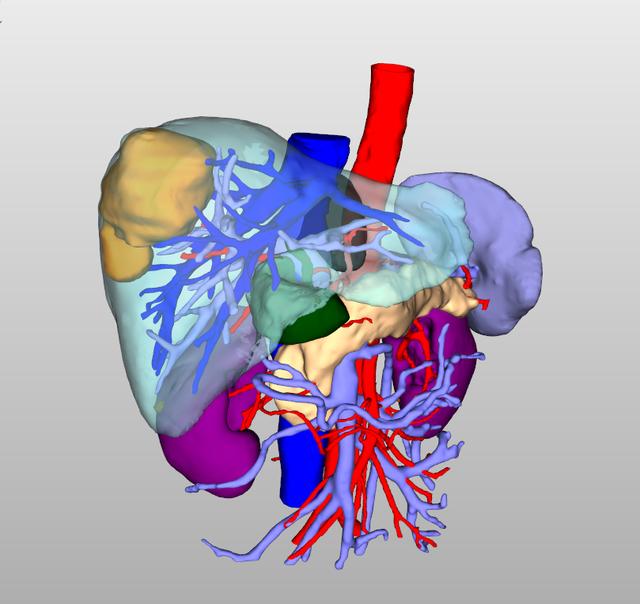 肝脏一体化成像一次一体化扫描成像肝脏平扫及增强肝动