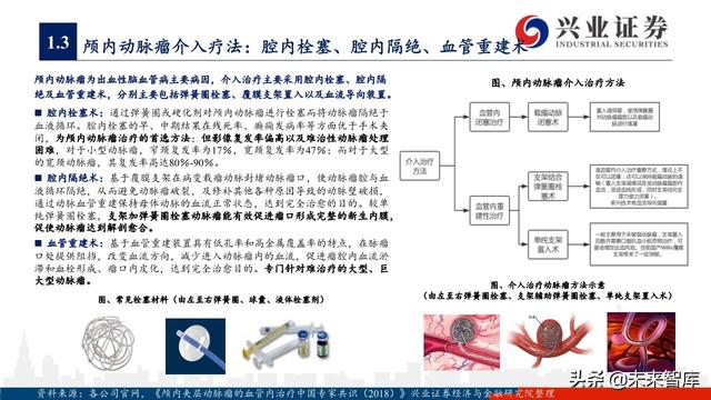 神经介入器械投资策略：百亿市场尚处起步期，国产替代潜力巨大