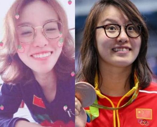 有种“整容”叫傅园慧，整完牙后判若两人，网