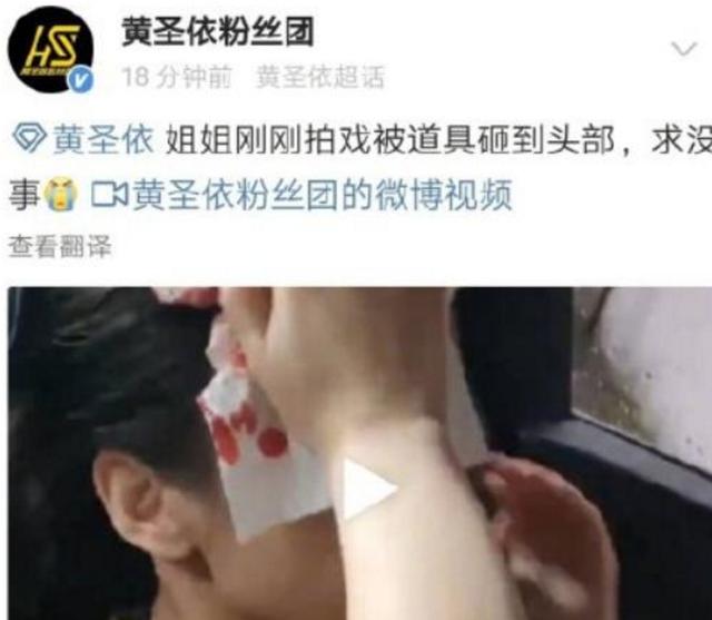 头部|黄圣依拍戏时头部受伤！被道具砸头血流不止 隔着屏幕都能感到非常疼