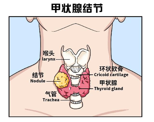 肺结节甲状腺结节乳腺结节到底切不切一篇文章说清了