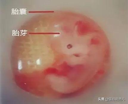 胚芽什么时候出现(胚芽大小与孕周对照表)