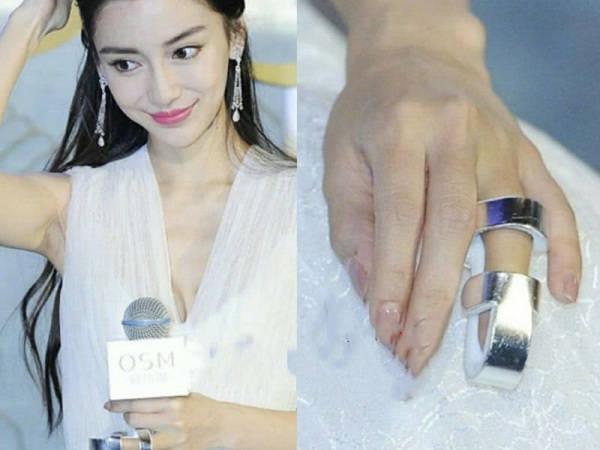 明星参加综艺有多危险？杨颖骨折， 李晨医院缝