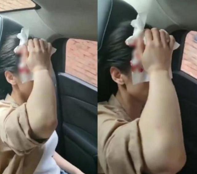 头部|黄圣依拍戏时头部受伤！被道具砸头血流不止 隔着屏幕都能感到非常疼