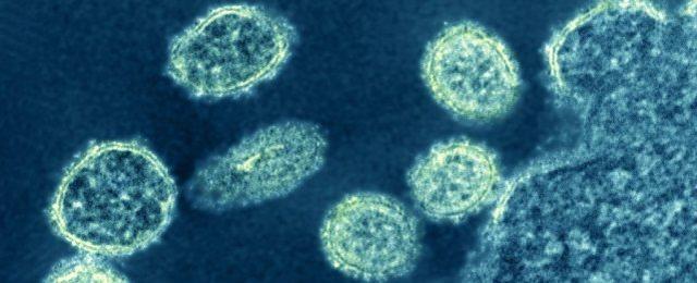 中国研究者发现了一种具有“全球大流行潜力”的新型猪流感病毒