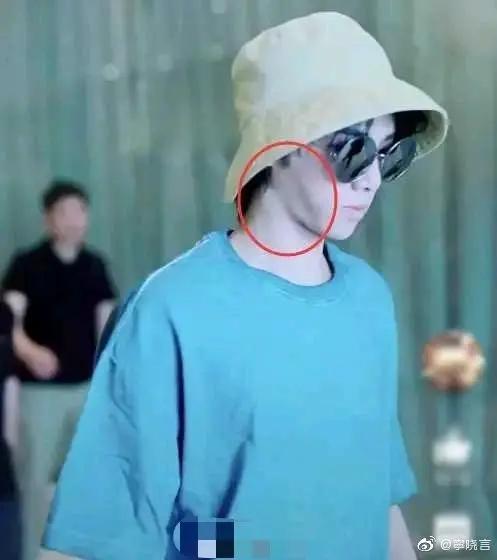华晨宇整容失败恐成削古天帝？自肖战整容之后