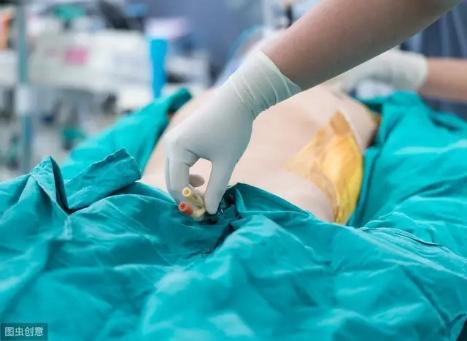 导尿流程图(女性导尿消毒的顺序)