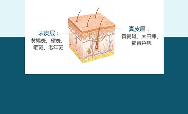 脸上的色斑别再“放任不管”，淡化色斑有方法，成分选对事半功倍