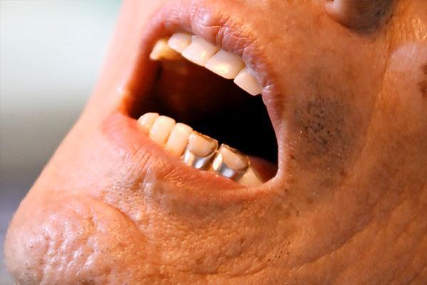 人到中年，嘴里老是有股怪味道，是什么原因？