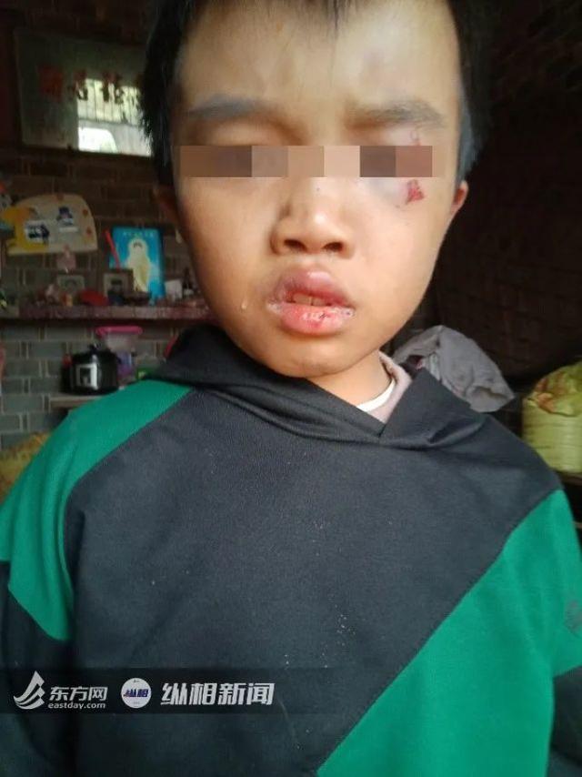江西12岁男童满身伤痕惨死家中，父母被拘，还牵出8年前卖掉另一孩子