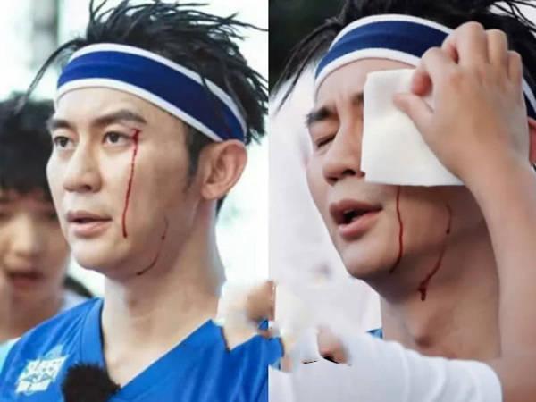 明星参加综艺有多危险？杨颖骨折， 李晨医院缝