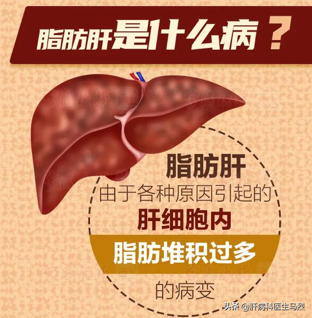 Why Do Doctors Ask These Questions When Diagnosing Fatty Liver? iNEWS