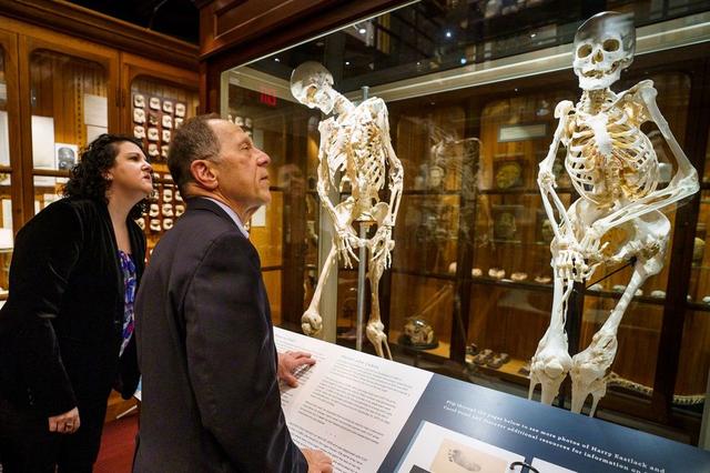 The 'weird disease' with 'explosive' bone growth, they don't hesitate ...