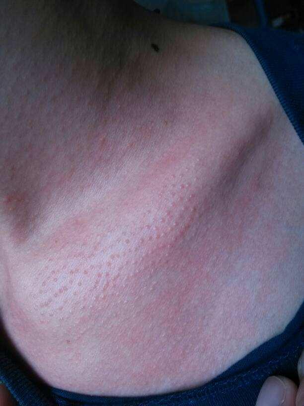 Don't ignore the "small particles" on the neck, pay attention, this is