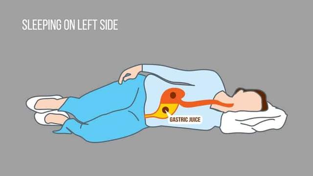 Lying On Your Left Side Reduces Acid Reflux During Sleep - Inews