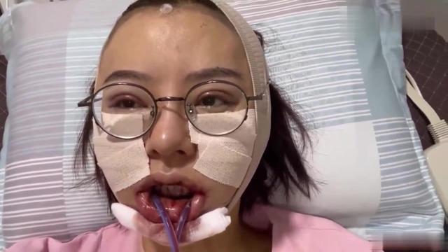 改脸型要多少钱(教你揉颧骨改变脸型)