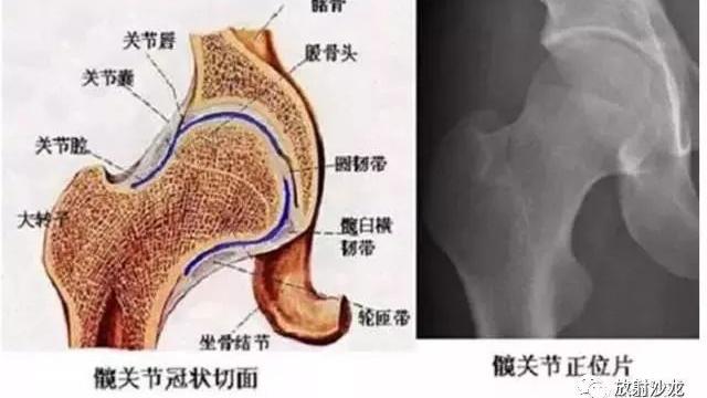 ECT联合X线、CT在腰腿痛患者中的诊断价值