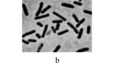 细菌特殊结构的染色观察及实验室检验