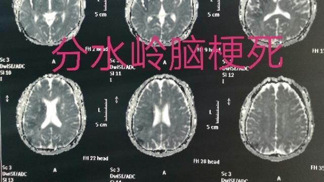 留得青山在不怕没柴烧成语解释