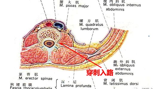 腰骶丛应用解剖及临床意义