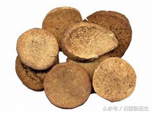 治疗痛风各症状对应中药配方!它们的用量