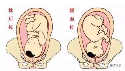 问答丨怀孕几个月检查胎位?胎位不正怎么