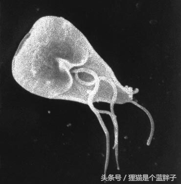 10大最恶心的寄生虫（人体前十寄生虫大盘点）